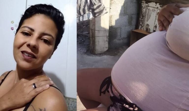 Com tumor gigante, mulher é confundida com grávida e implora por ajuda: “Não aguento mais dor”