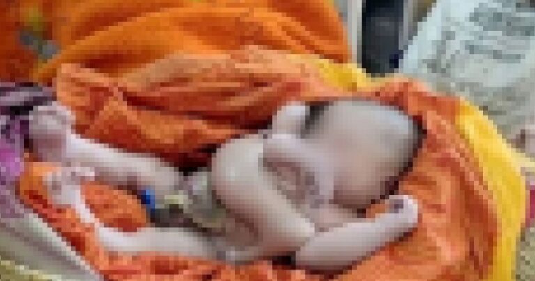 Bebê que nasceu com 4 pernas e 4 braços vem sendo tratado como a reencarnação de um deus