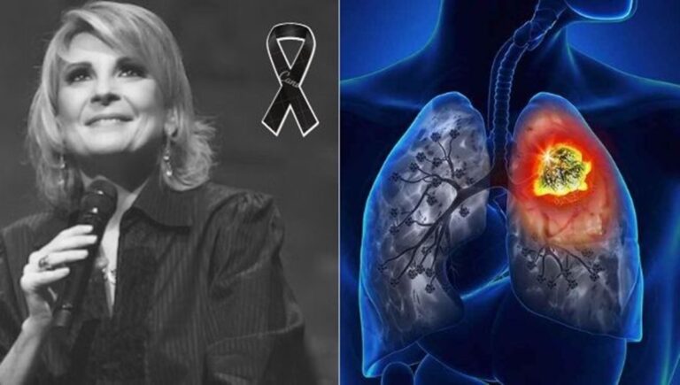 Ludmila Ferber: Confira 10 sintomas da doença que matou a cantora