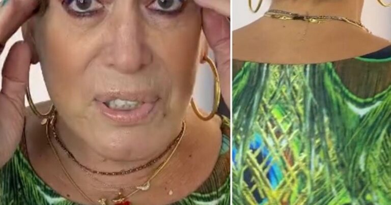 Vivendo com câncer sem cura, Susana Vieira corta cabelo e desabafa em vídeo: ‘Tudo pro chão’