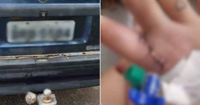 Vídeo mostra os ferimentos de mulher que foi amarrada em engate de carro e arrastada pelo namorado-Imagens fortes
