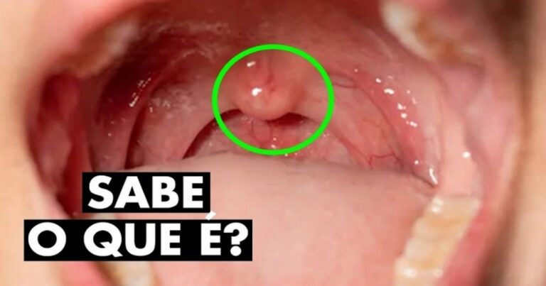 Você sabe para que serve o sininho que temos na garganta? Você vai se surpreender ao descobrir