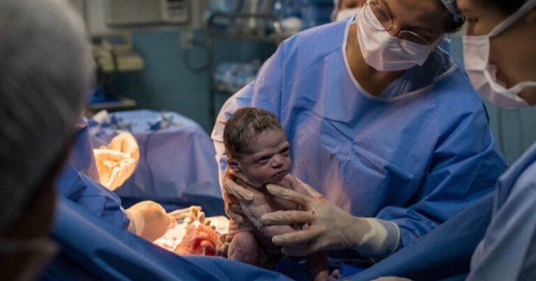 Lembra dela? Bebê com ‘cara de brava’ completou 2 anos; ela continua cheia de personalidade