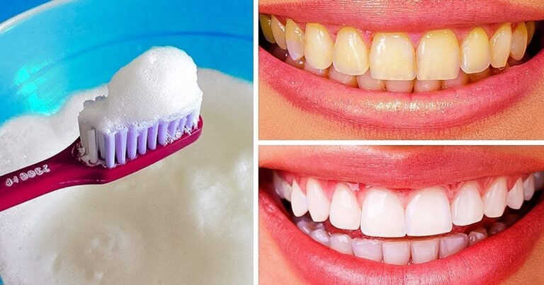 Deixe seus dentes brancos e brilhantes com apenas R$ 3,00 usando ‘Eno’