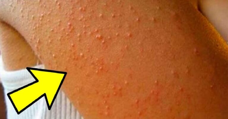 Aparecem essas bolinhas em seu braço? Então você precisa saber disso urgentemente