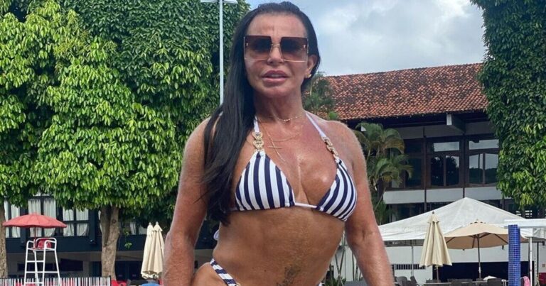 Gretchen posta foto de biquíni, mas o que chama a atenção é outra coisa: ‘É assim mesmo?’