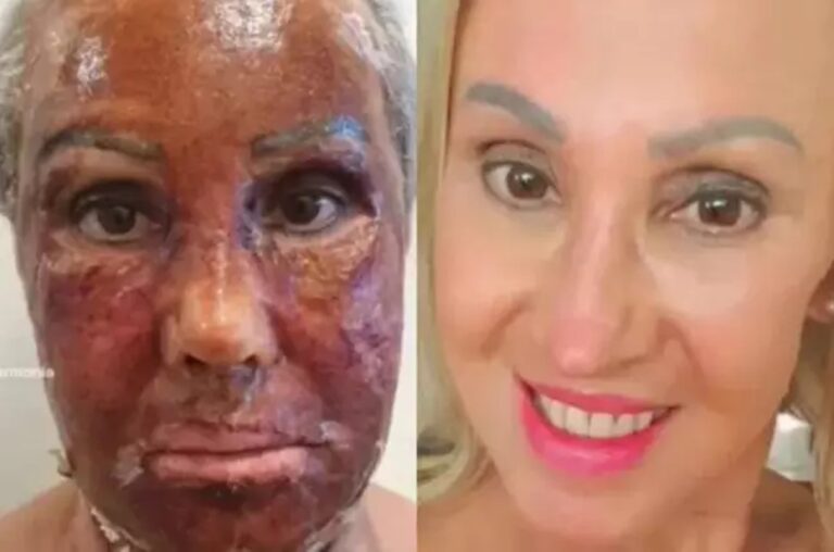Vídeo: Mulher ‘troca de rosto’ após procedimento estético e mudança viraliza nas redes sociais