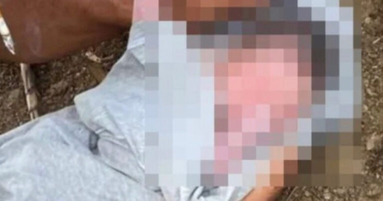 Recém-nascida é jogada em rio dentro de mochila e resgatada por ribeirinhos