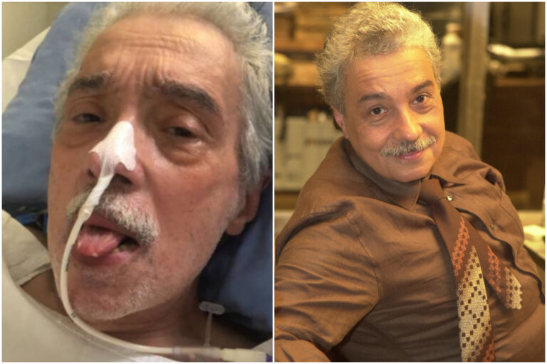 Saiba os sintomas da DPOC, doença que afetou o ator Pedro Paulo Rangel