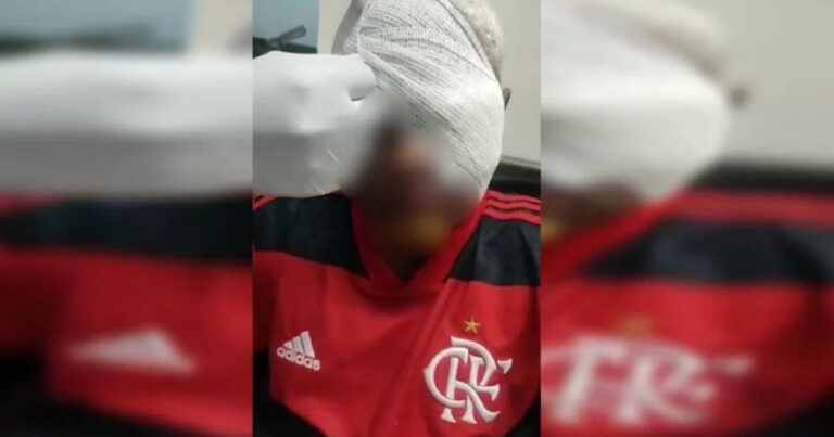 Adolescente autista perde o olho após ser maltratado durante brincadeira: ‘violência sem tamanho’