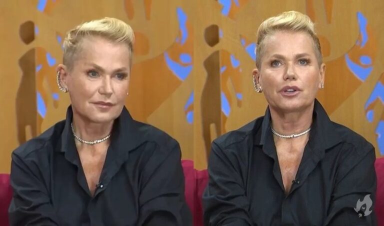Xuxa revela que sofreu paralisia após cirurgia plástica sem sua permissão