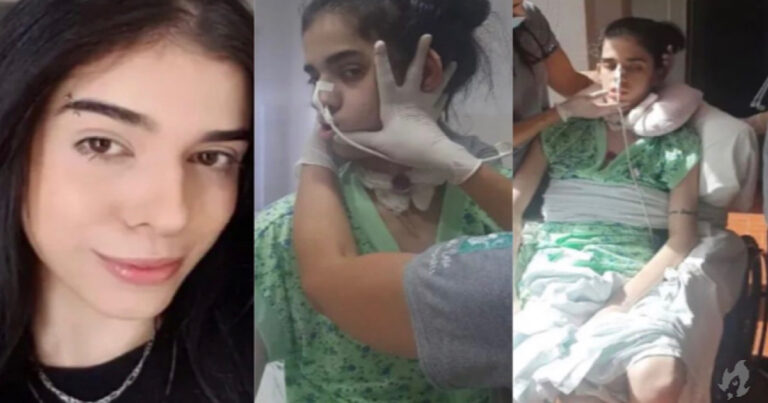 Jovem que foi internada em estado grave após cheirar pimenta toma banho de sol pela primeira vez