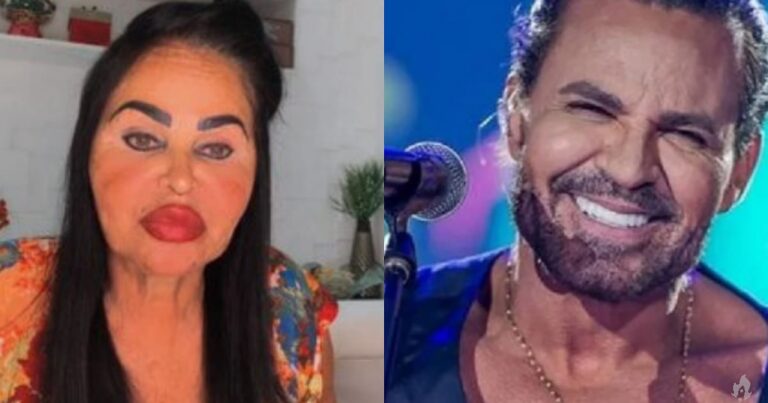 Mãe de Eduardo Costa é criticada após realizar harmonização facial