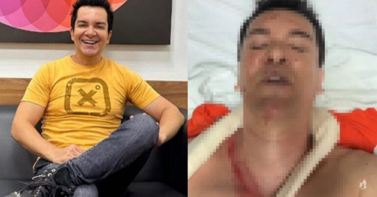 Regis Danese passa por nova cirurgia, mas deixa a UTI