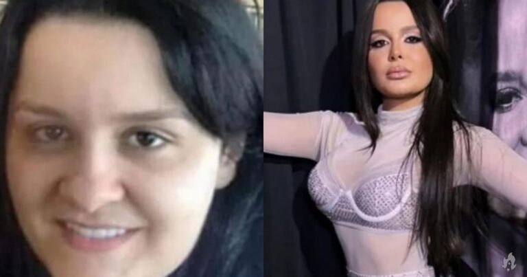 ‘Antes e depois’ de Maraisa vira tema de debate nas redes sociais