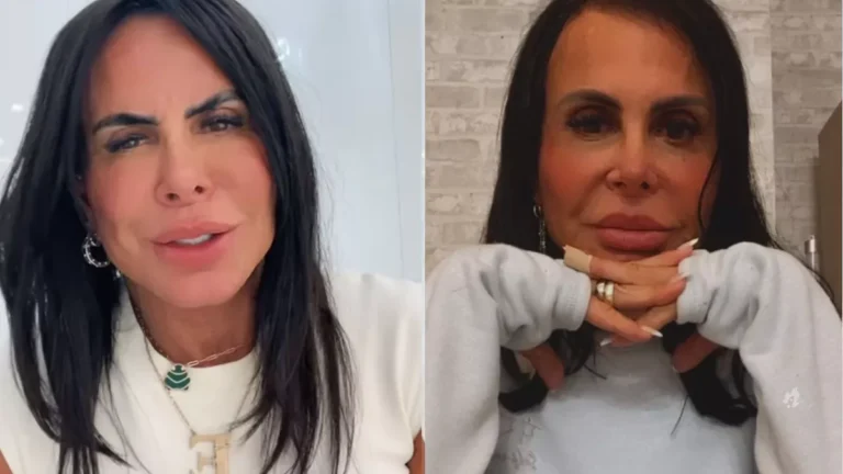 Gretchen se interna faz desabafo emocionante: “Cirurgia delicada”