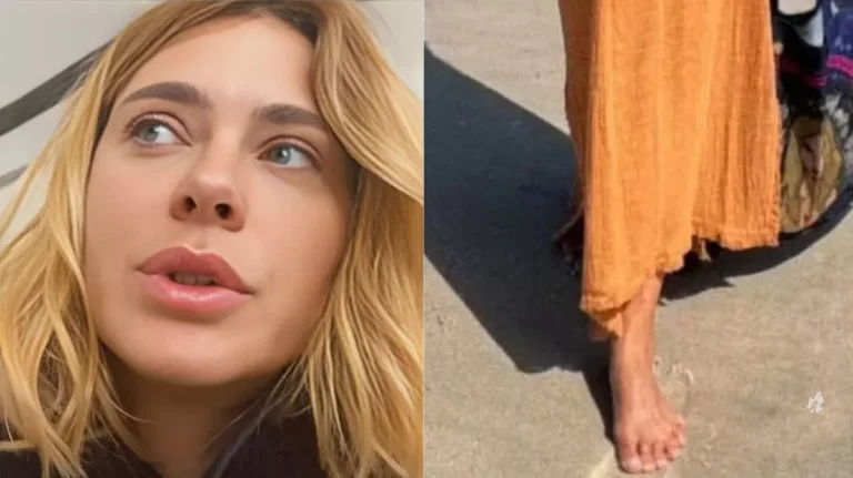 Carolina Dieckmann tem seis dedos no pé? Atriz se pronuncia e fala a verdade