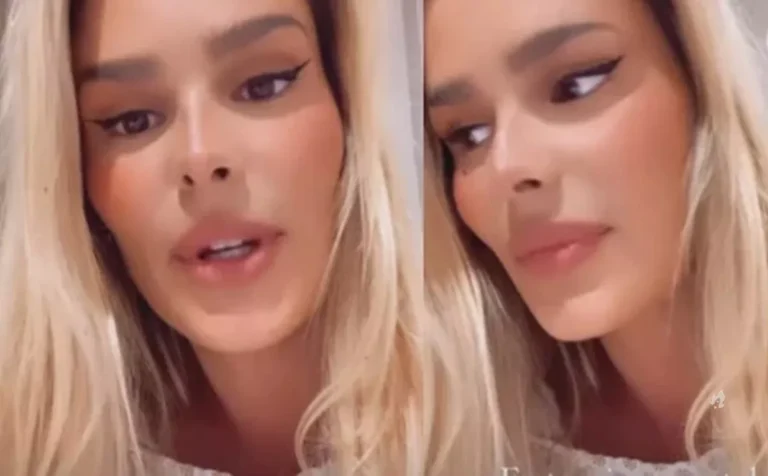 Yasmin Brunet rompe o silêncio e fala sobre seu tratamento contra o lipedema
