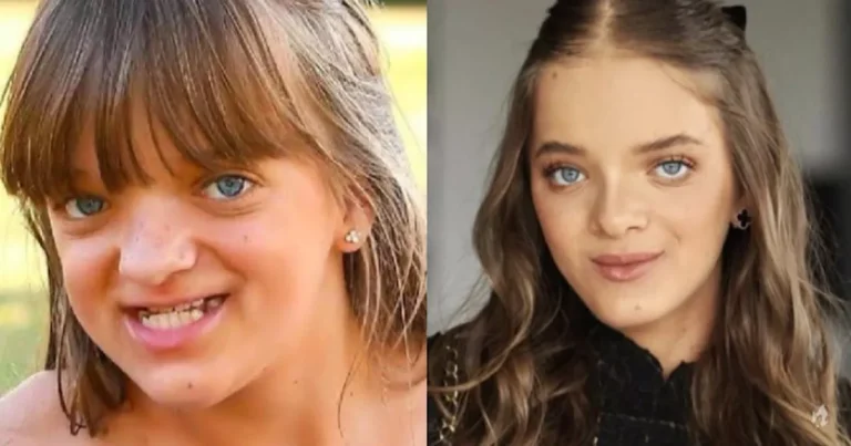 Rafaella Justus reage ao ser questionada sobre plástica antes dos 18 anos