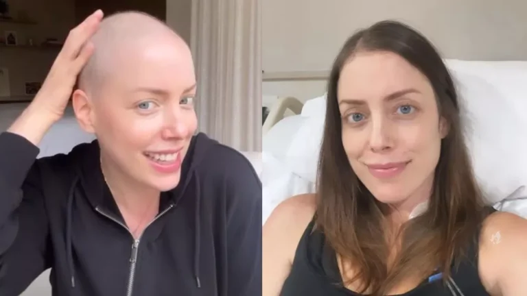 Fabiana Justus agradece elogios após queda de cabelo e faz breve reflexão sobre autoestima: “Faz a diferença”