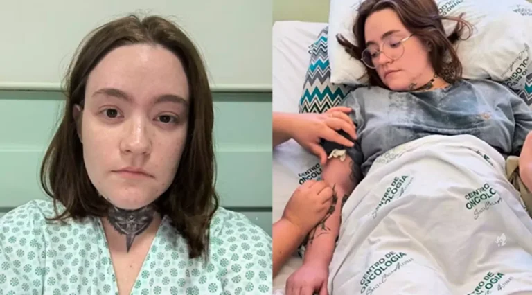 Estudante com neuralgia do trigêmeo tem alta da UTI após tratamento: ‘Experiência inédita’