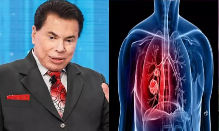 Broncopneumonia: entenda a causa que tirou a vida de Silvio Santos