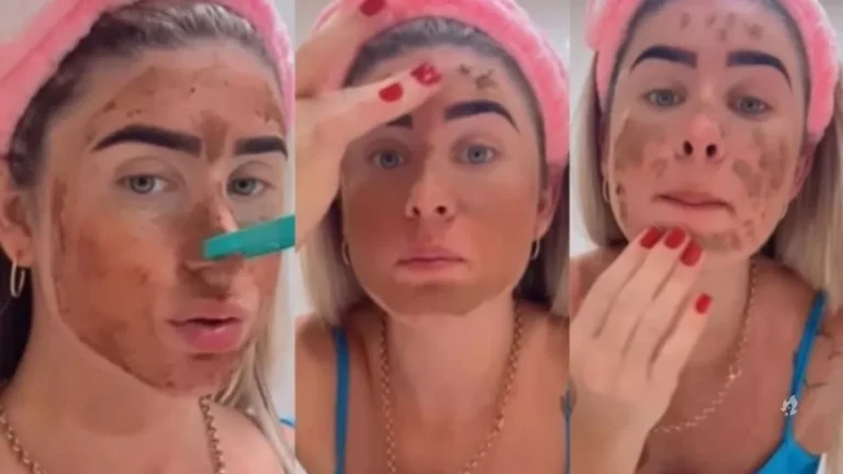 Tome conhecimento dos perigos de passar estrume no rosto como tratamento facial