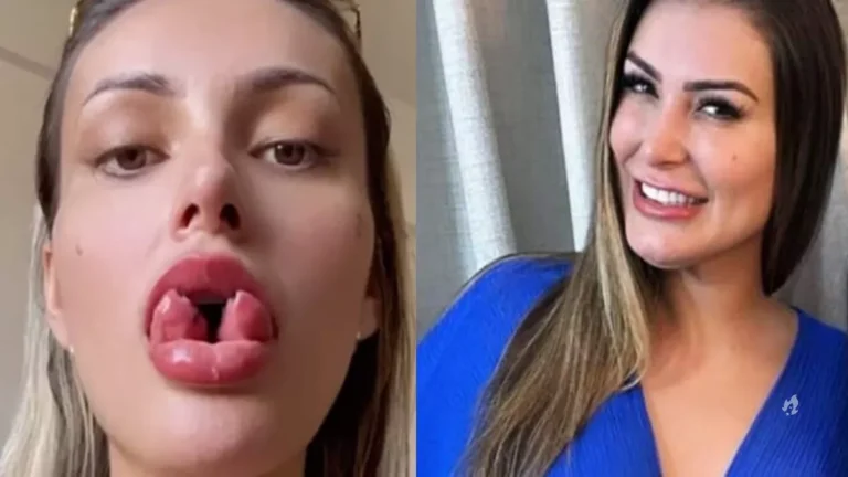 Andressa Urach faz nova transformação no corpo após bifurcar a língua: “De ouro!”