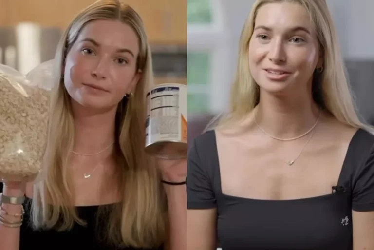 Mulher com doença rara faz forte desabafo nas redes sociais: “Um simples beijo pode me matar”