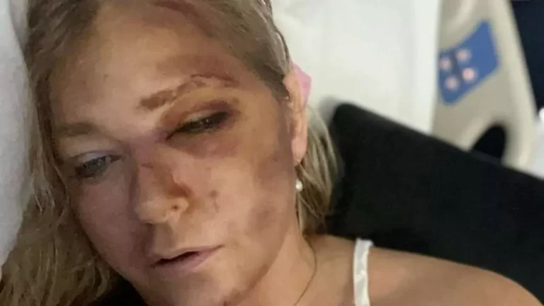 “Me deram 4 dias de vida. Estou pronta pra partir”, diz mulher que acusou Príncipe Andrew de abuso
