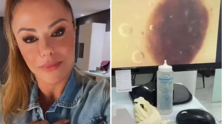Poliana Rocha vai ao médico ver pinta suspeita descoberta pela neta: “A Flor que achou”