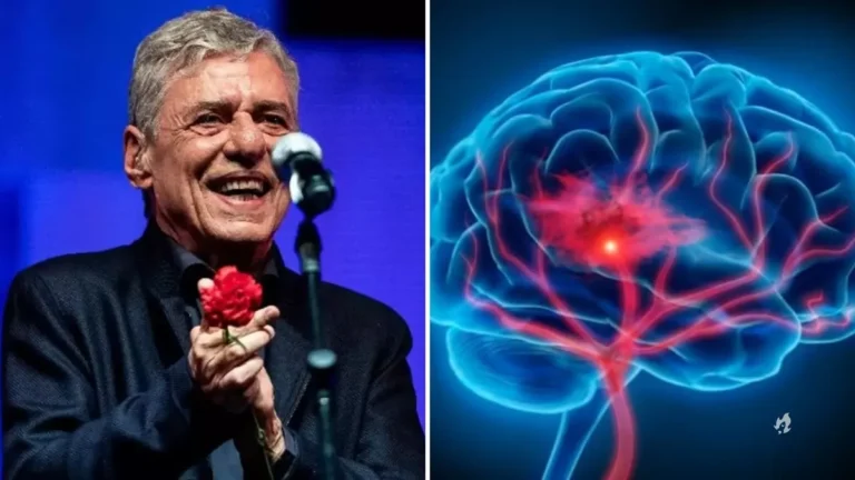 Após cirurgia no crânio, especialista explica quadro de Chico Buarque