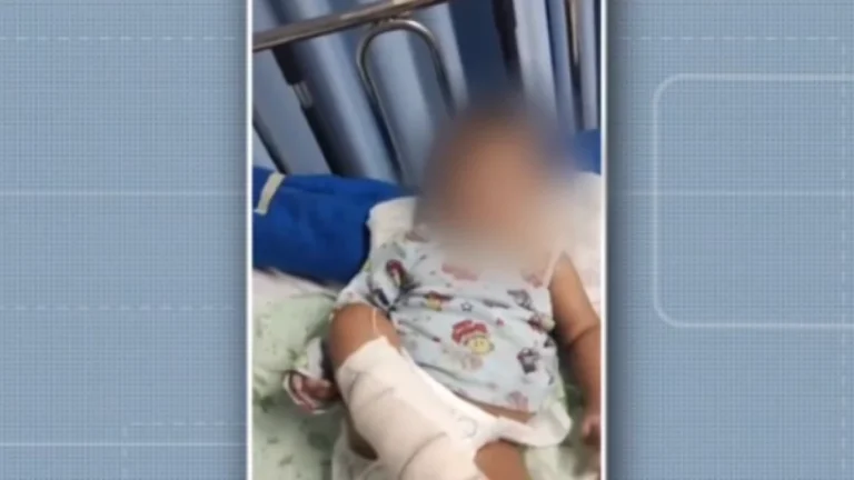 Bebê é internado com bronquiolite e precisa amputar o pé; família acusa hospital de negligência