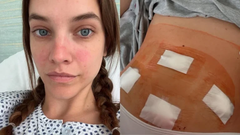 Modelo expõe batalha contra doença e faz alerta: “Te encorajo a investigar”
