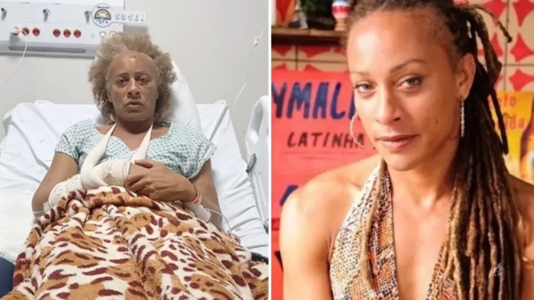 Famosa atriz de ‘Ó Paí, Ó’ passa por cirurgia após ser agredida por ex-companheiro