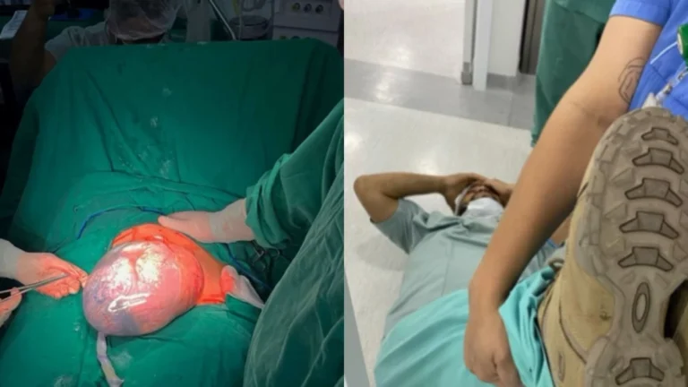 Hospital de SC tem dois partos raros de gêmeos empelicados: “Pai desmaiou”
