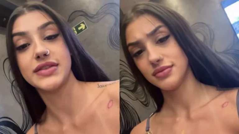 Bia Miranda mostra ferimento após acidente com Gato Preto; veja