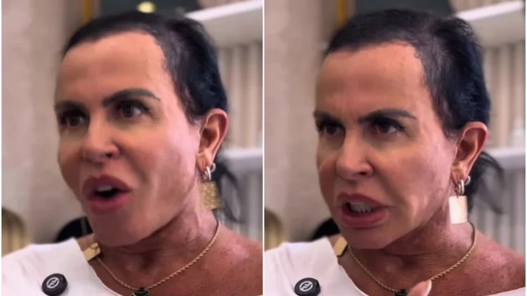 Com alopecia, Gretchen passa por transformação no visual