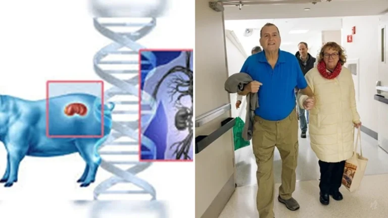 Homem choca a todos por estar vivo após receber transplante de rim de porco