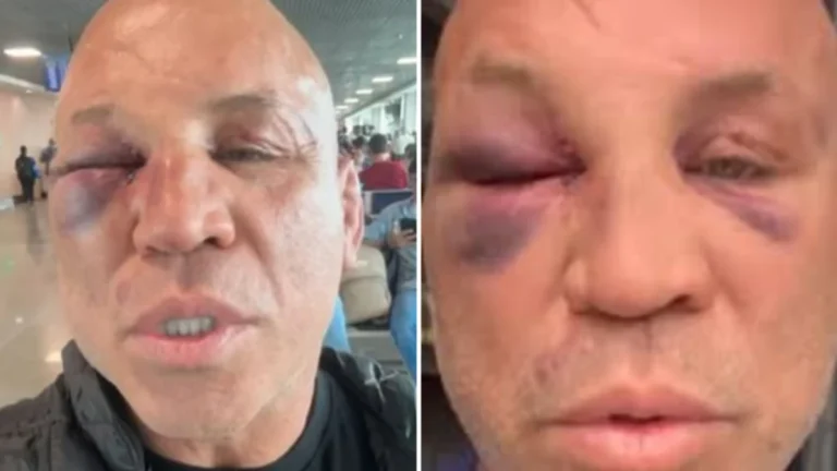 Wanderlei Silva revela que vai entrar na Justiça após sofrer agressões durante confusão