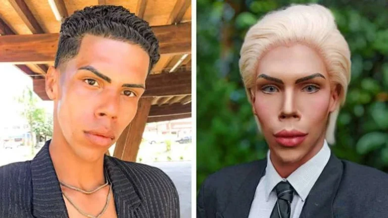 Aos 21 anos, ex-Ken Humano desabafa sobre crise financeira: Luz atrasada e sem alimento