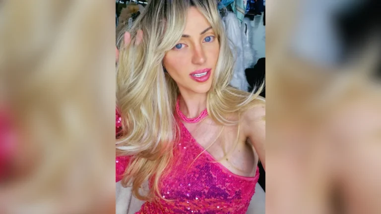 “Barbie Humana”: defensor diz ter tentado reanimar influencer por 9 minutos