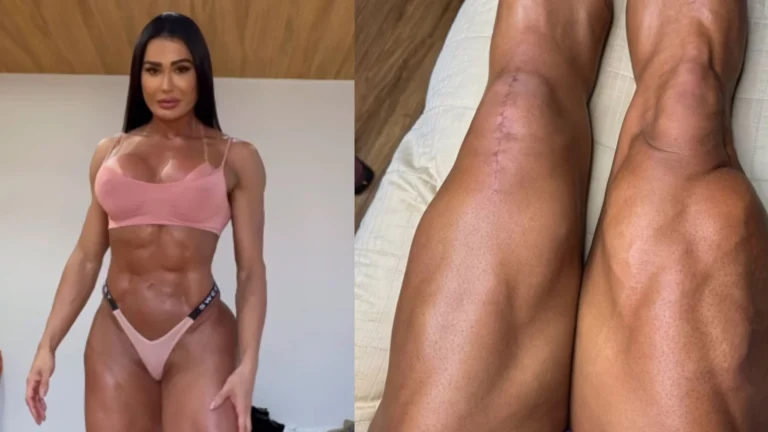 Gracyanne Barbosa responde críticas sobre aparência de suas pernas; veja