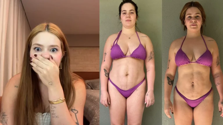 Viih Tube mostra resultado da lipo após 5 meses “Muito feliz”; veja