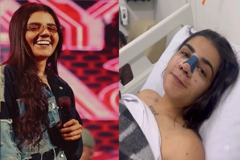 Cantora Yasmin Santos revela resultado da plástica no nariz e choca seguidores