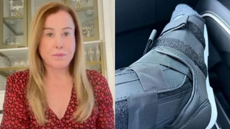 SUSTO! Zilu Camargo sofre acidente em casa: Estou toda detonada