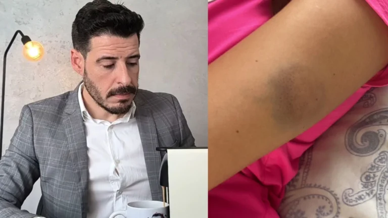 “Calvo do Campari” nega tentativa de estupro e fala em agressões mútuas