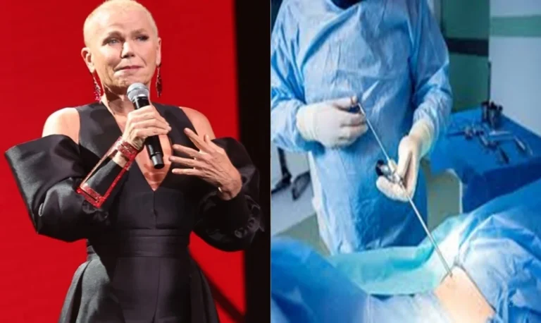 Xuxa é internada às pressas e passa por cirurgia em SP, boletim médico revela quadro