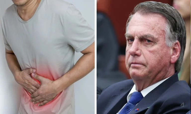 Perícia da PF acende alerta e indica cirurgia urgente em Bolsonaro