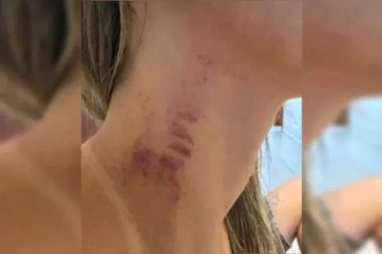 Influenciadora coloca câmeras em casa e consegue flagrar agressão do ex